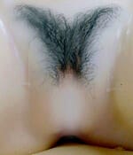 images, pubic hair implant